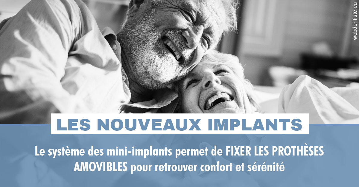 https://dr-roy-remy.chirurgiens-dentistes.fr/Les nouveaux implants 2