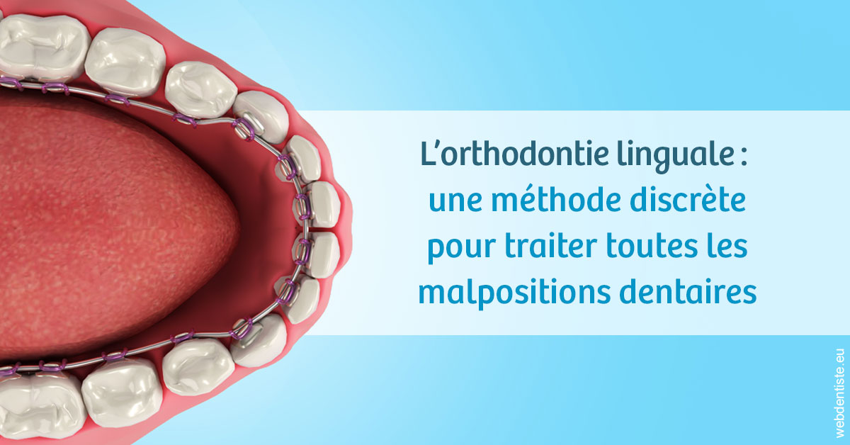 https://dr-roy-remy.chirurgiens-dentistes.fr/L'orthodontie linguale 1