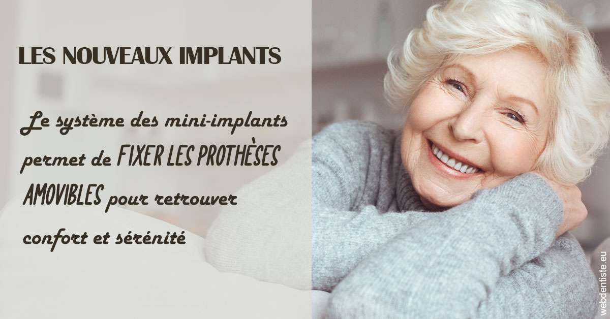 https://dr-roy-remy.chirurgiens-dentistes.fr/Les nouveaux implants 1