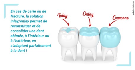 https://dr-roy-remy.chirurgiens-dentistes.fr/L'INLAY ou l'ONLAY