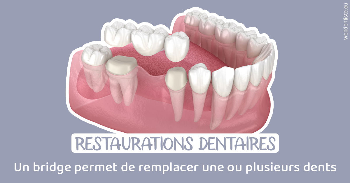 https://dr-roy-remy.chirurgiens-dentistes.fr/Bridge remplacer dents 1