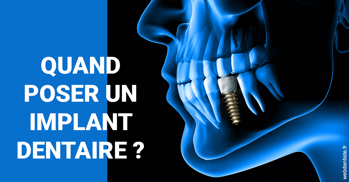 https://dr-roy-remy.chirurgiens-dentistes.fr/Les implants 1