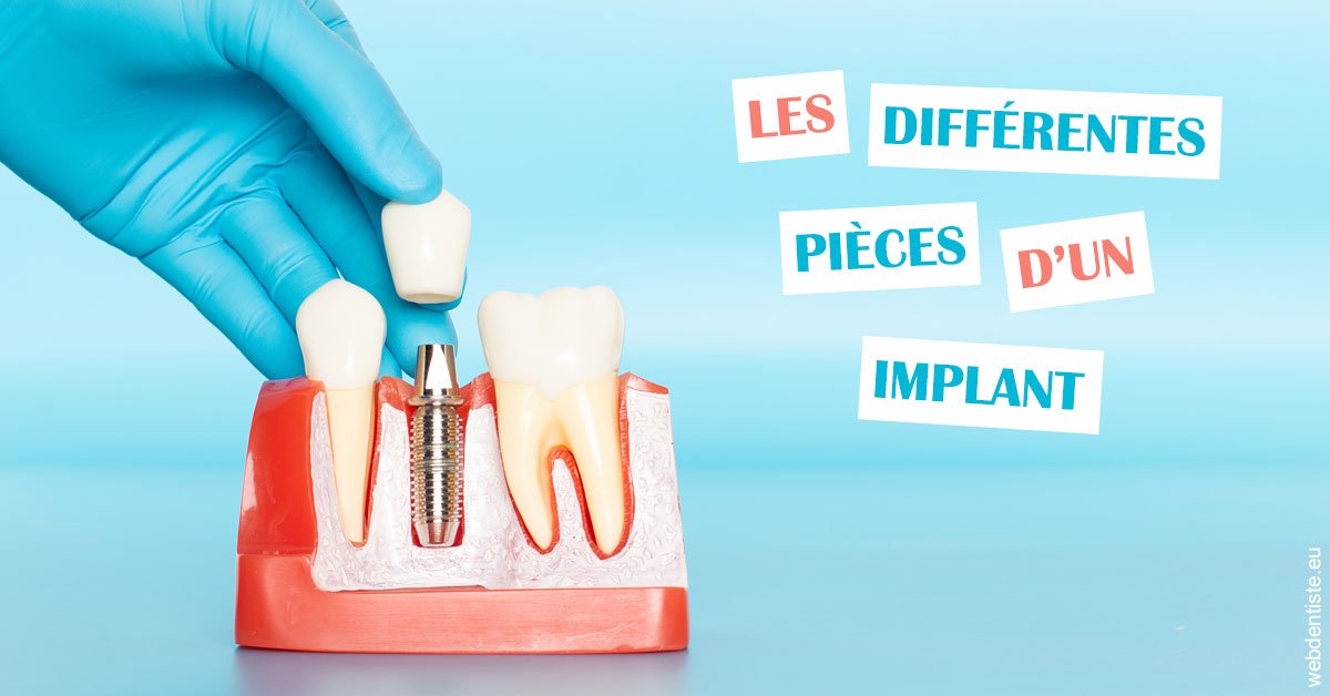 https://dr-roy-remy.chirurgiens-dentistes.fr/Les différentes pièces d’un implant 2