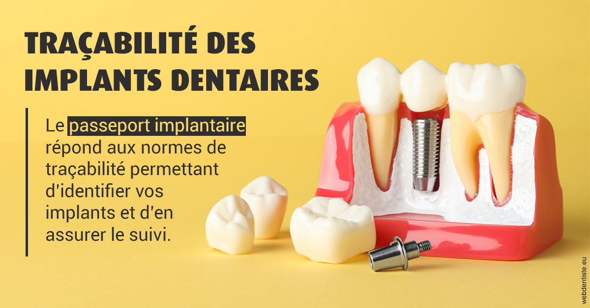 https://dr-roy-remy.chirurgiens-dentistes.fr/T2 2023 - Traçabilité des implants 2