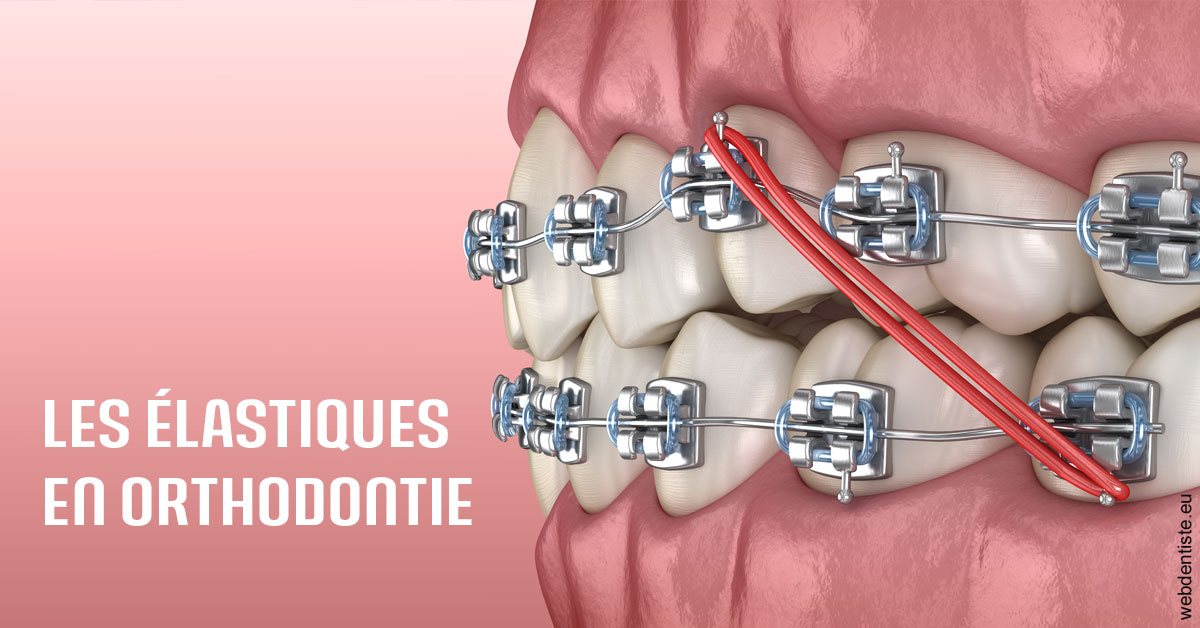 https://dr-roy-remy.chirurgiens-dentistes.fr/Elastiques orthodontie 2