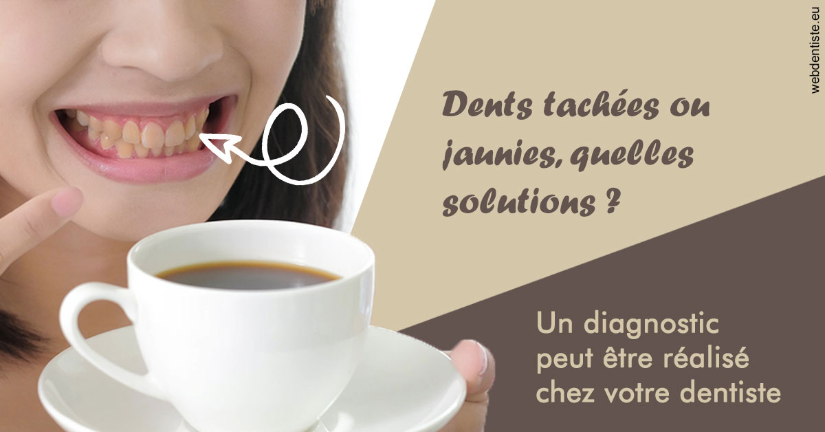 https://dr-roy-remy.chirurgiens-dentistes.fr/Dents tachées 1