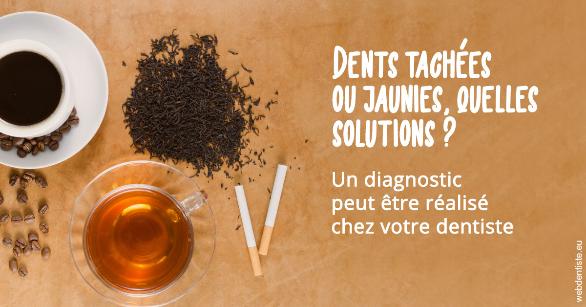 https://dr-roy-remy.chirurgiens-dentistes.fr/Dents tachées 2