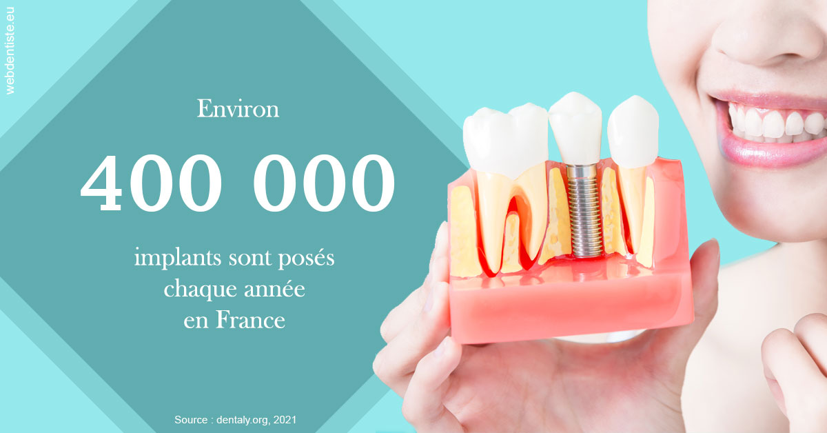 https://dr-roy-remy.chirurgiens-dentistes.fr/Pose d'implants en France 2